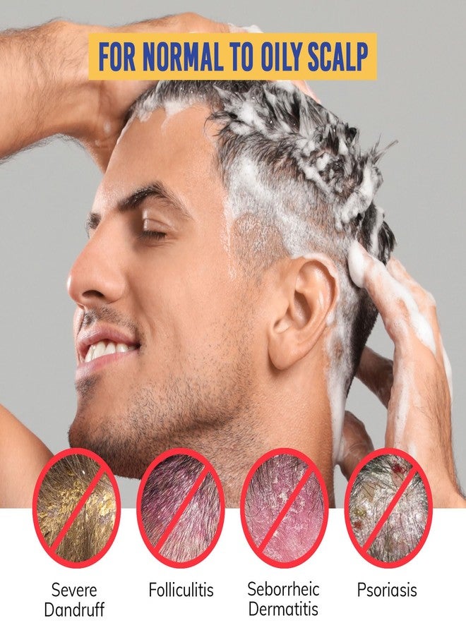 RootStim Seborrheic Dermatitis Folliculitis Dandruff Shampoo - Anti Fungal Medicated Shampoo for Healthy Scalp with Selenium Sulfide & Botanical Extracts - Flakes Itchy and Oily Scalp Relief Stop Hair Loss - Image 3